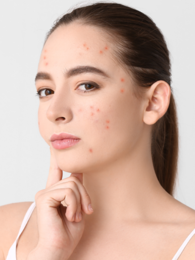Winter Skin Problem | हिवाळा सुरु झाला कि त्वचेवर लालसरपणा, त्वचेला खाज येऊ लागते पण हे येण्याची काय कारणे आहेत?